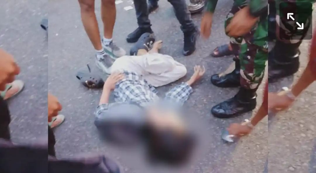 Dilindas Truk TNI, Pelajar 14 Tahun Berjuang Hidup, Janji Kodam Disorot